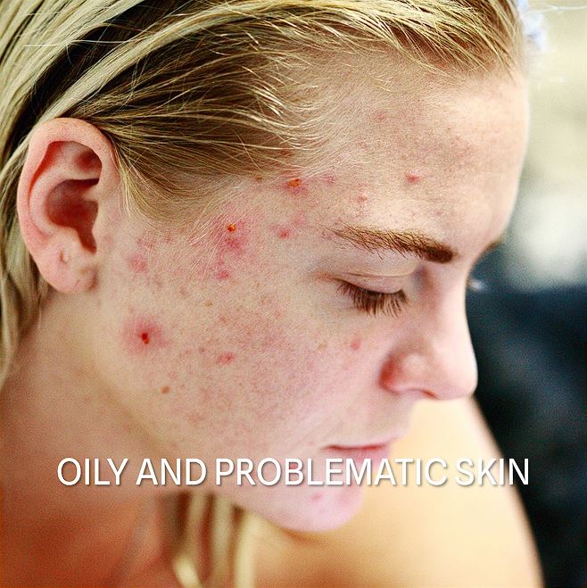 05 Masna I Problematicna Koza