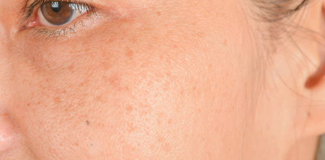 kako-plavo-svetlo-ekrana-utice-na-vasu-kozu-i-kako-da-se-zastitite