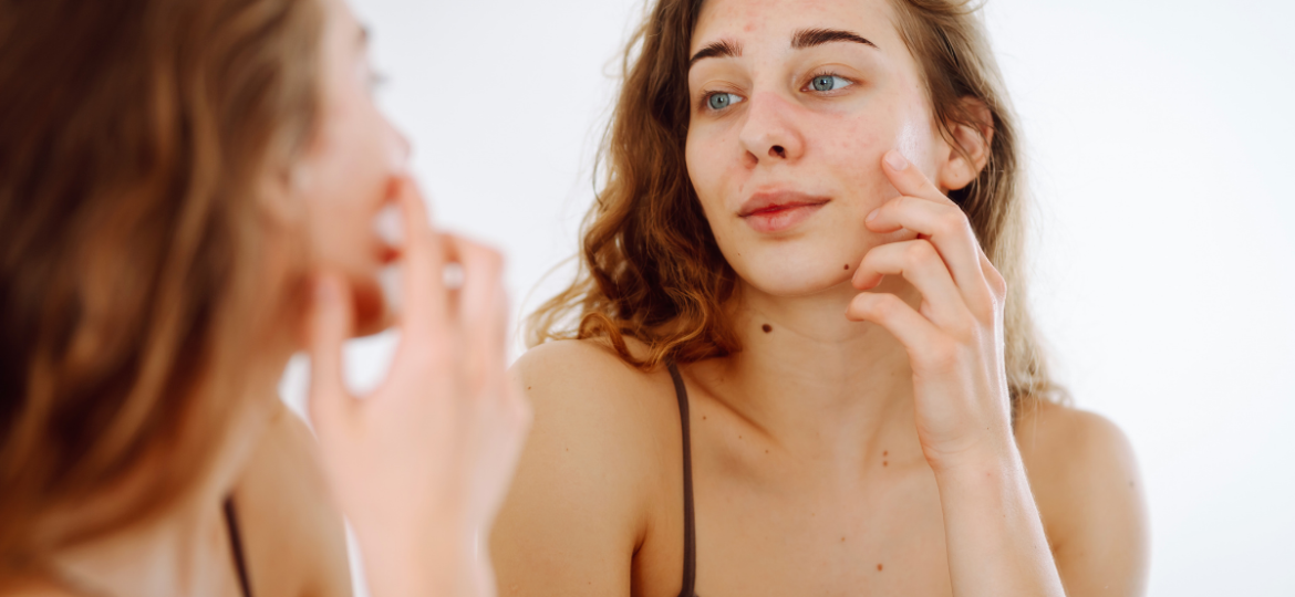 bubuljice kod odraslih zena